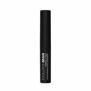 EvolutionMan Conceal & Treat Men's Concealer